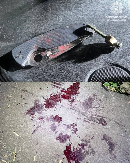 Накинувся на людей біля під’їзду, поранений у лікарні: у Чернігові затримали підозрюваного у вчиненні злочину