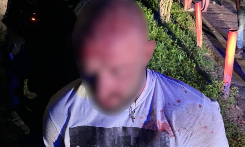 Накинувся на людей біля під’їзду, поранений у лікарні: у Чернігові затримали підозрюваного у вчиненні злочину