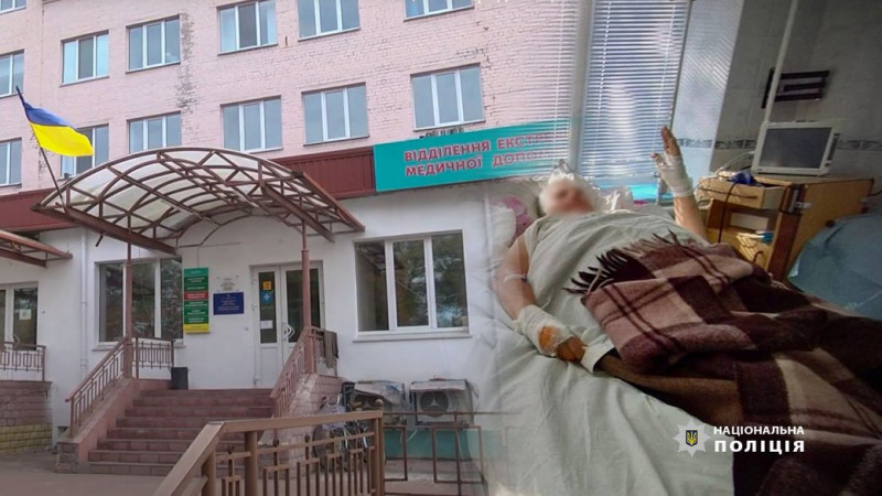 Медики розповіли про стан 74-річної жительки Костобоброва, що на Чернігівщині, яка зазнала поранення внаслідок атаки РФ