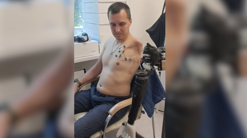 "Немає таких вправ, які не можна зробити однією рукою": історія ветерана Володимира Милька, який втратив руку на війні
