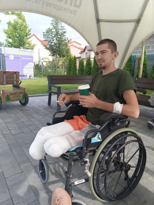 Воїн із Чернігівщини втратив обидві ноги та потребує допомоги