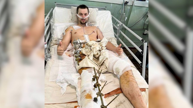 Фізичний терапевт з Чернігівщини зазнав поранень у боях, а після реабілітації повернувся до роботи з пацієнтами