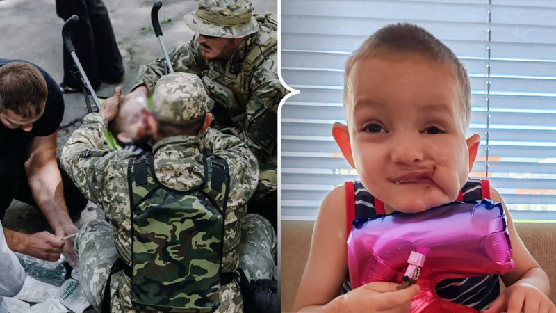 "Ходить до садочка та працює над вимовою": що відомо про хлопчика, який зазнав травм під час вибуху на Валу у Чернігові