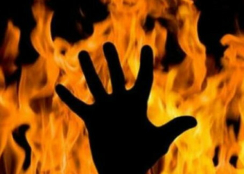 У селі на Чернігівщині чоловік отримав серйозні опіки під час пожежі в будинку У селі на Чернігівщині чоловік отримав серйозні опіки під час пожежі в будинку