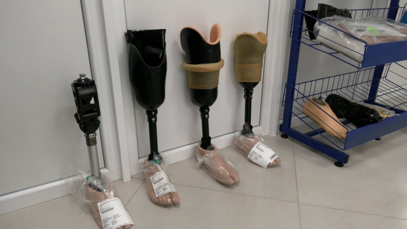 100 виробів за 2 роки: центр протезування у Чернігові, де виготовляють протези ніг, планує виготовляти ще й протези рук