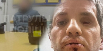 У Чернігові поліцейські напали на ветерана, після чого у нього стався епілептичний напад