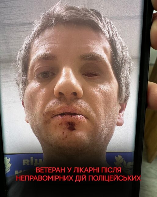 У Чернігові поліцейські напали на ветерана, після чого у нього стався епілептичний напад