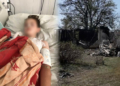 «Попереду ще тривале лікування»: у якому стані хлопчик, який зазнав опіків через атаку РФ по селу Володькова Дівиця